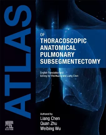 Atlas of Thoracoscopic Anatomical Pulmonary Subsegmentectomy cover