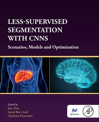 Less-Supervised Segmentation with CNNs cover