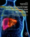 Safe Major Hepatectomy after Preoperative Liver Regeneration cover