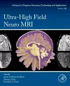 Ultra-High Field Neuro MRI cover