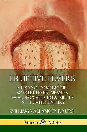 Eruptive Fevers: A History of Medicine - Scarlet Fever, Measles, Small-Pox and Treatments in the 19th Century cover