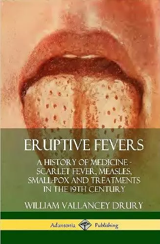 Eruptive Fevers: A History of Medicine - Scarlet Fever, Measles, Small-Pox and Treatments in the 19th Century (Hardcover) cover