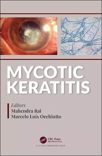 Mycotic Keratitis cover