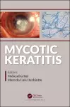 Mycotic Keratitis cover