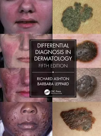 Differential Diagnosis in Dermatology cover