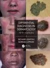 Differential Diagnosis in Dermatology cover