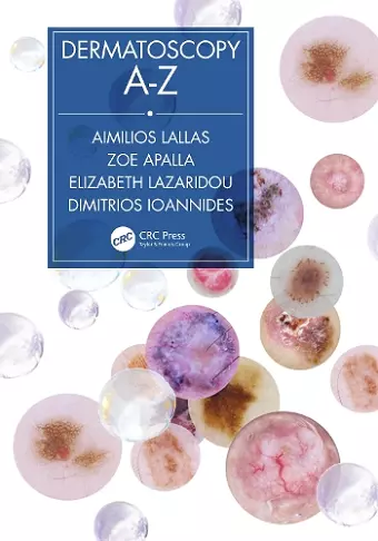 Dermatoscopy A-Z cover