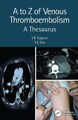 A to Z of Venous Thromboembolism cover