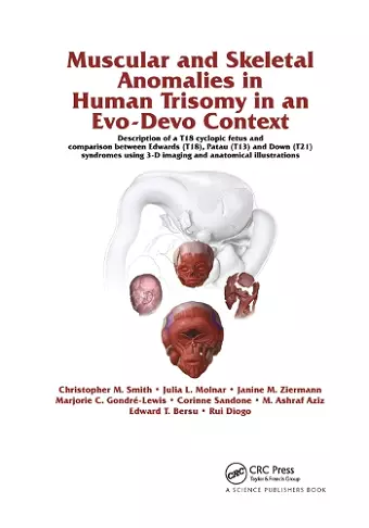 Muscular and Skeletal Anomalies in Human Trisomy in an Evo-Devo Context cover