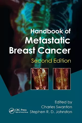 Handbook of Metastatic Breast Cancer cover