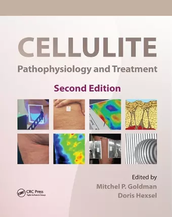 Cellulite cover