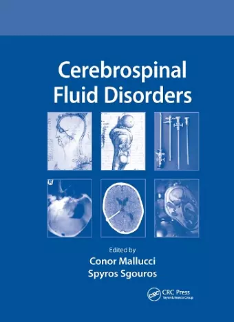 Cerebrospinal Fluid Disorders cover