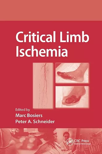 Critical Limb Ischemia cover