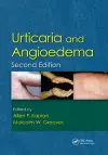 Urticaria and Angioedema cover