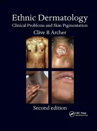 Ethnic Dermatology cover