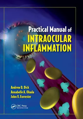 Practical Manual of Intraocular Inflammation cover