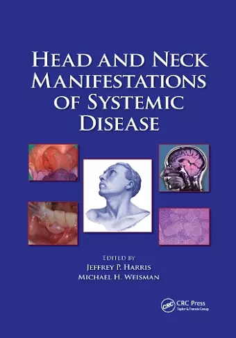 Head and Neck Manifestations of Systemic Disease cover