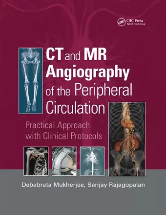 CT and MR Angiography of the Peripheral Circulation cover