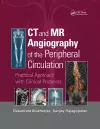 CT and MR Angiography of the Peripheral Circulation cover