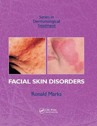 Facial Skin Disorders cover