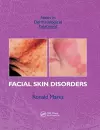 Facial Skin Disorders cover