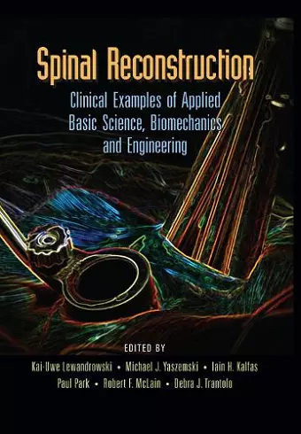 Spinal Reconstruction cover