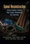 Spinal Reconstruction cover