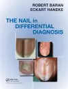 Nail in Differential Diagnosis cover