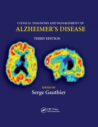 Clinical Diagnosis and Management of Alzheimer's Disease cover