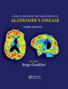 Clinical Diagnosis and Management of Alzheimer's Disease cover