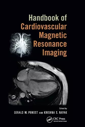 Handbook of Cardiovascular Magnetic Resonance Imaging cover