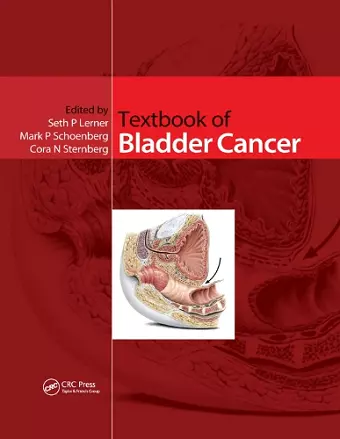 Textbook of Bladder Cancer cover