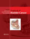 Textbook of Bladder Cancer cover