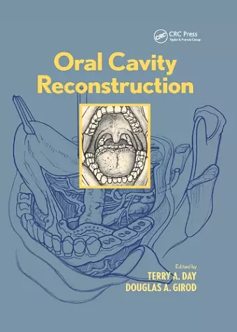 Oral Cavity Reconstruction cover