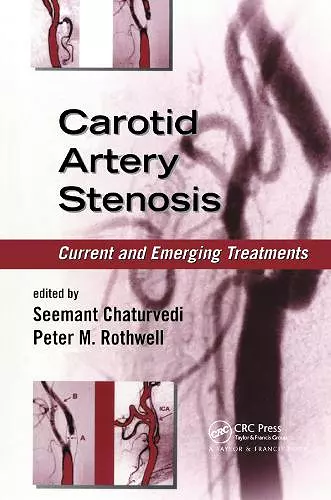 Carotid Artery Stenosis cover