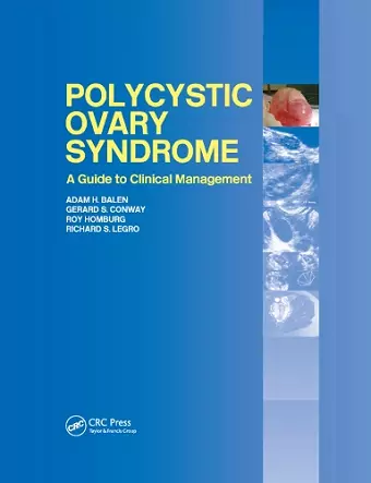 Polycystic Ovary Syndrome cover