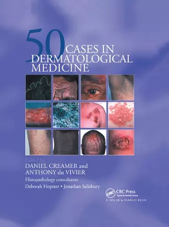 Fifty Dermatological Cases cover