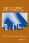 Fractures of the Upper Extremity cover