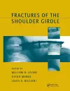 Fractures of the Shoulder Girdle cover