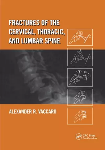 Fractures of the Cervical, Thoracic, and Lumbar Spine cover