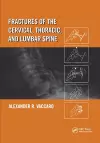 Fractures of the Cervical, Thoracic, and Lumbar Spine cover