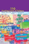 One Hundred Case Studies in Epilepsy cover