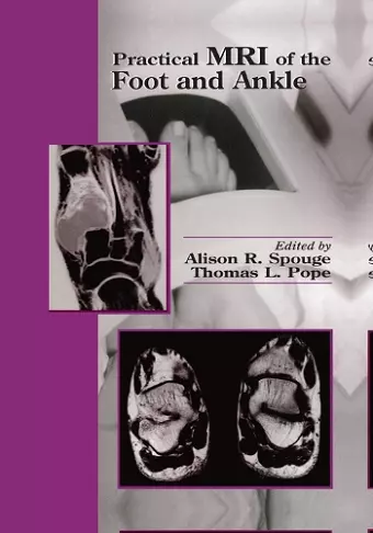 Practical MRI of the Foot and Ankle cover