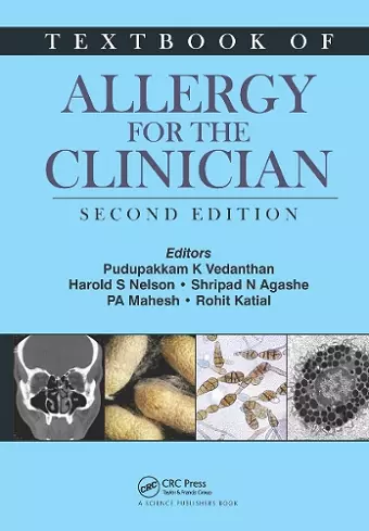 Textbook of Allergy for the Clinician cover