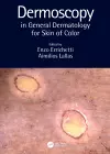 Dermoscopy in General Dermatology for Skin of Color cover