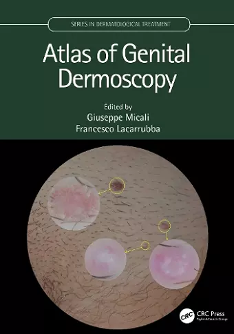 Atlas of Genital Dermoscopy cover