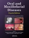 Oral and Maxillofacial Diseases, Fourth Edition cover