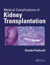 Medical Complications of Kidney Transplantation cover