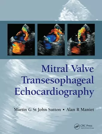 Mitral Valve Transesophageal Echocardiography cover