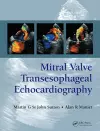 Mitral Valve Transesophageal Echocardiography cover